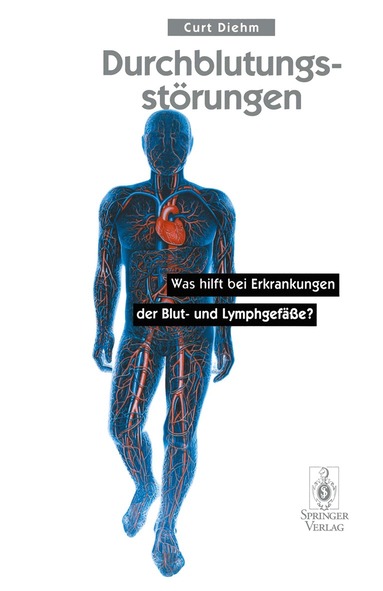 Curt Diehm - Durchblutungsstörungen, Häftad
