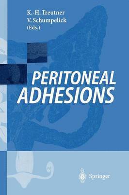 Karl-Heinz Treutner, Volker Schumpelick - Peritoneal Adhesions, Häftad