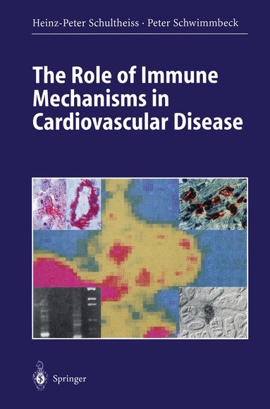 Heinz-Peter Schultheiss, Peter Schwimmbeck - Role of Immune Mechanisms in Cardiovascular Disease, Häftad