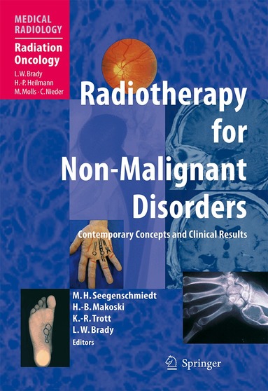 Michael Heinrich Seegenschmiedt, Hans-Bruno Makoski, Klaus-Rüdiger Trott, Luther W. Brady - Radiotherapy for Non-Malignant Disorders, Inbunden