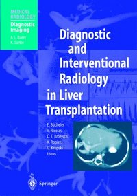 bokomslag Diagnostic and Interventional Radiology in Liver Transplantation