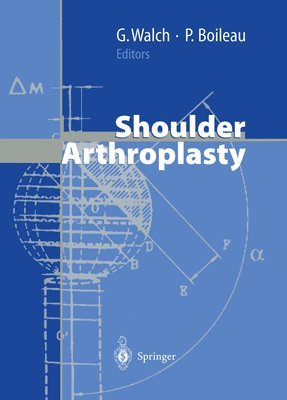 Shoulder Arthroplasty 1