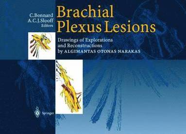 bokomslag Brachial Plexus Lesions