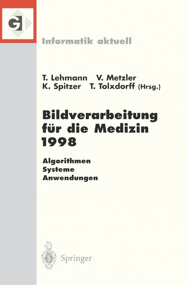 Thomas Lehmann, Volker Metzler, Klaus Spitzer, Thomas Tolxdorff - Bildverarbeitung für die Medizin 1998, Häftad