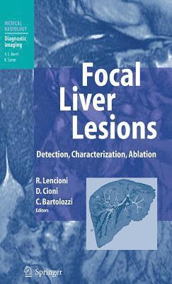 bokomslag Focal Liver Lesions