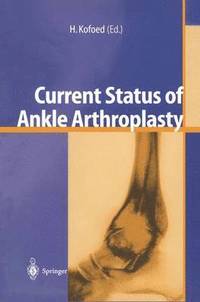 bokomslag Current Status of Ankle Arthroplasty
