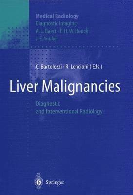 bokomslag Liver Malignancies