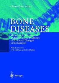 bokomslag Bone Diseases
