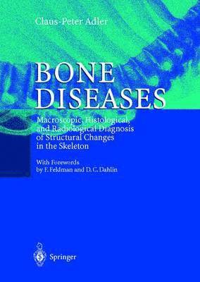 Bone Diseases 1