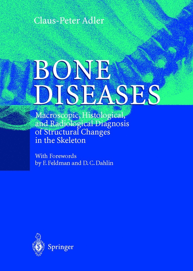 Claus-Peter Adler, C. P. Adler - Bone Diseases, Inbunden