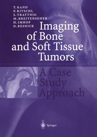 bokomslag Imaging of Bone and Soft Tissue Tumors