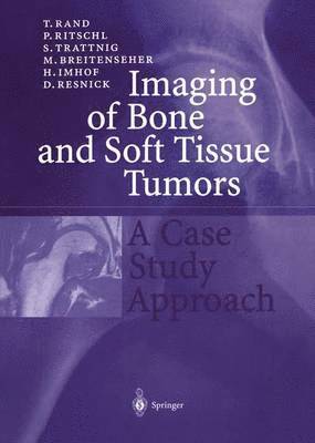 Imaging of Bone and Soft Tissue Tumors 1