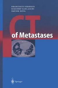 bokomslag CT of Metastases