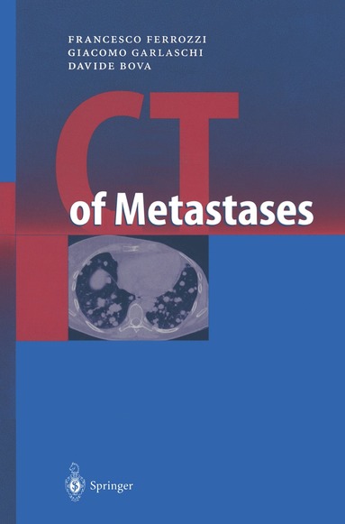 bokomslag CT of Metastases