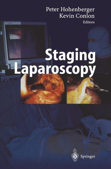 bokomslag Staging Laparoscopy