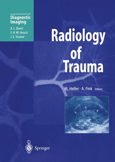 Martin Heller, A. Fink - Radiology of Trauma, Häftad
