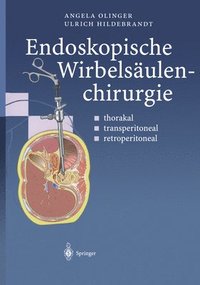 bokomslag Endoskopische Wirbelsaulenchirurgie