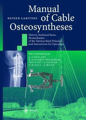 The Manual of Cable Osteosyntheses 1