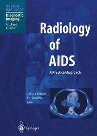 bokomslag Radiology of AIDS