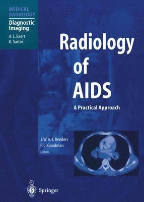 bokomslag Radiology of AIDS