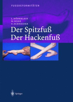 L Dvderlein, W Wenz, U Schneider, L Daderlein, Leonhard Daderlein, Wolfram Wenz, Urs Schneider, Leonhard Doderlein - Fussdeformitaten, Inbunden