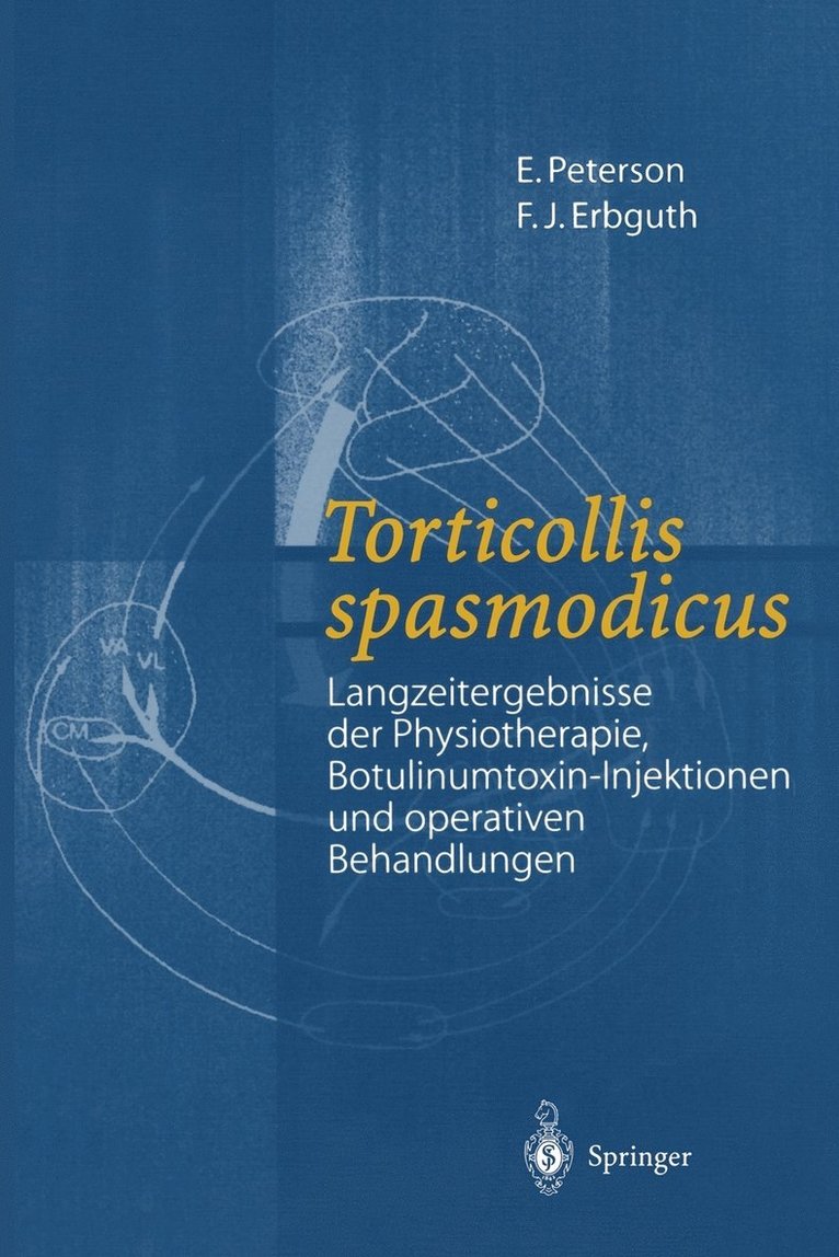 Torticollis spasmodicus 1