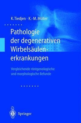 Kay Tiedjen, Klaus-Michael Müller, Kay Tiedjen, Klaus-Michael Müller - Pathologie der degenerativen Wirbelsäulenerkrankungen, Häftad