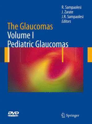 Roberto Sampaolesi, Jorge Zarate, Juan Roberto Sampaolesi - Glaucomas, Inbunden