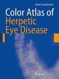 bokomslag Color Atlas of Herpetic Eye Disease