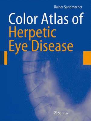Color Atlas of Herpetic Eye Disease 1
