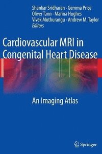bokomslag Cardiovascular MRI in Congenital Heart Disease