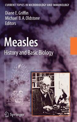 Measles 1