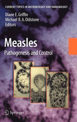 bokomslag Measles