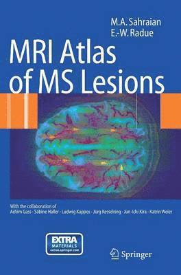 bokomslag MRI Atlas of MS Lesions