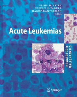 Hematologic Malignancies: Acute Leukemias 1