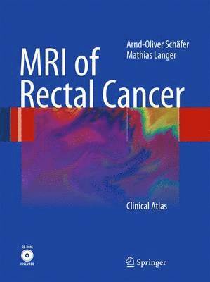 bokomslag MRI of Rectal Cancer