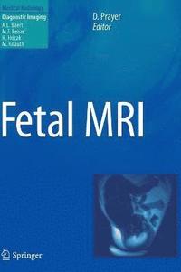 bokomslag Fetal MRI