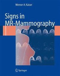 bokomslag Signs in MR-Mammography
