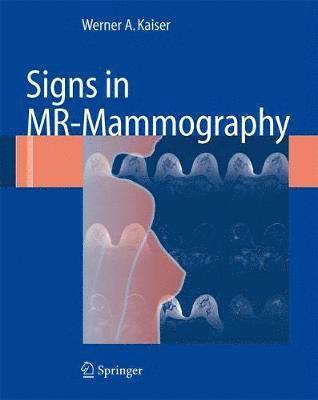 bokomslag Signs in MR-Mammography