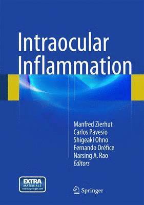 bokomslag Intraocular Inflammation