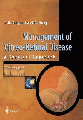 Management of Vitreo-Retinal Disease 1