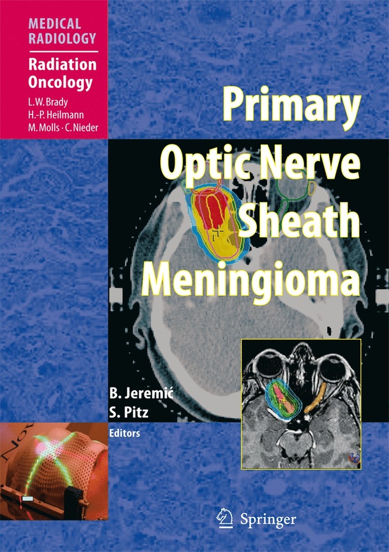 Branislav Jeremic, Susanne Pitz - Primary Optic Nerve Sheath Meningioma, Inbunden
