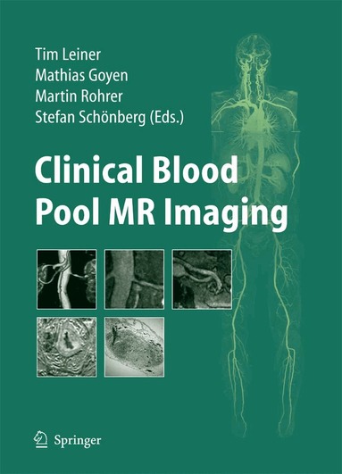 Tim Leiner, Mathias Goyen, Martin Rohrer, Stefan O. Schönberg - Clinical Blood Pool MR Imaging, Inbunden