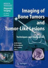 bokomslag Imaging of Bone Tumors and Tumor-Like Lesions