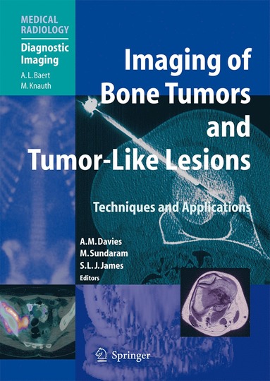 bokomslag Imaging of Bone Tumors and Tumor-Like Lesions