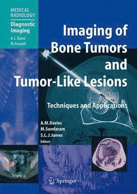 A. Mark Davies, Murali Sundaram, Steven J. James - Imaging of Bone Tumors and Tumor-Like Lesions, Inbunden