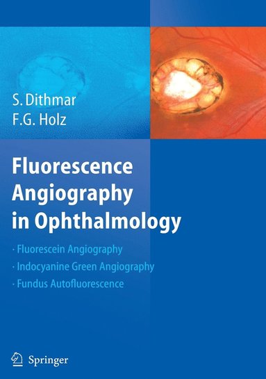 bokomslag Fluorescence Angiography in Ophthalmology