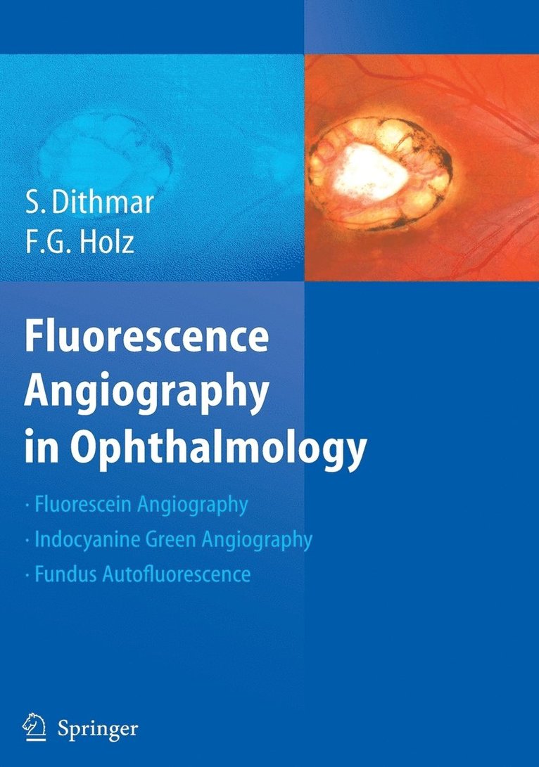 Fluorescence Angiography in Ophthalmology 1