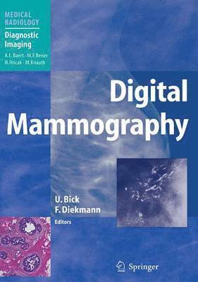 Ulrich Bick, Felix Diekmann - Digital Mammography, Inbunden