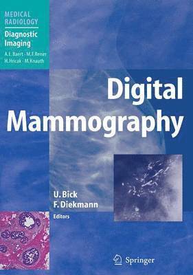 Digital Mammography 1